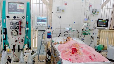 Cứu sống cháu bé bị ong đốt hơn 50 vết